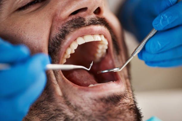 Dentist for Dental Trauma in WY