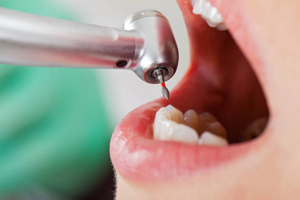 Best Dentist for Dental Trauma  in South Park, WY
